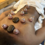 Practitioner performing wet cupping therapy on back for detoxification